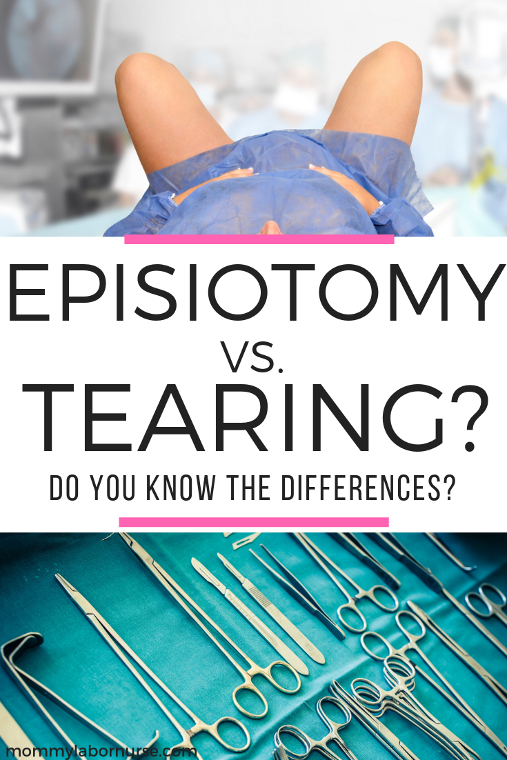 episiotomy vs tearing