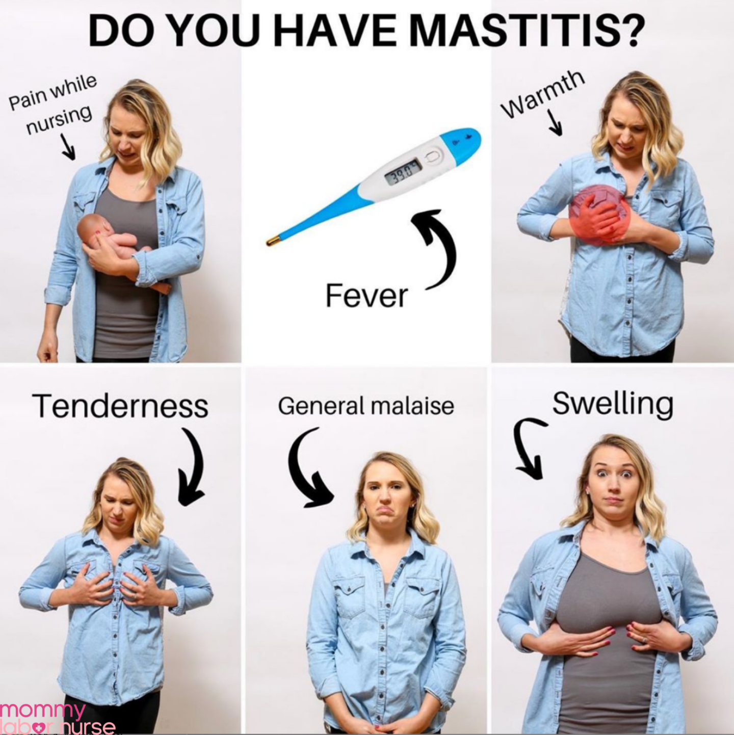 mastitis signs and symptoms infographic
