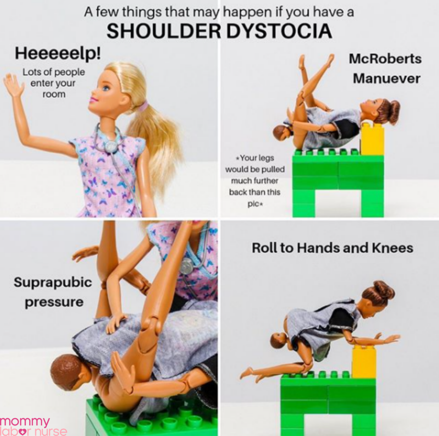 shoulder dystocia infographic