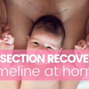 c section recovery timeline