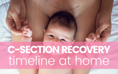 C-Section Recovery Timeline at Home