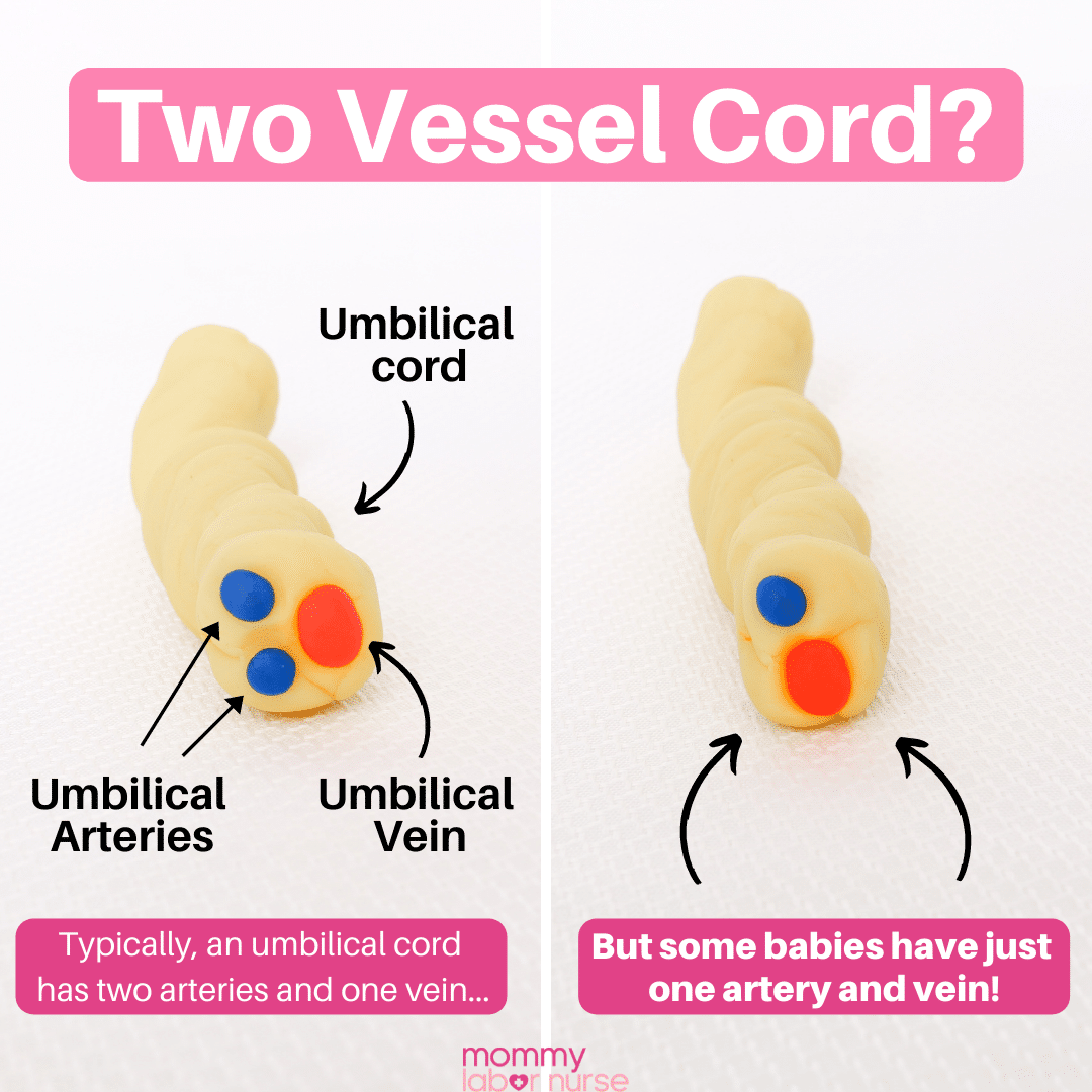 Anatomy Of Umbilical Cord Two Umbilical Arteries And One Umbilical Porn Sex Picture